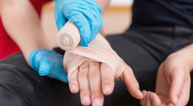 Understanding Burn Injury Compensation Lawyer in the UK : Getting the Compensation You Deserve