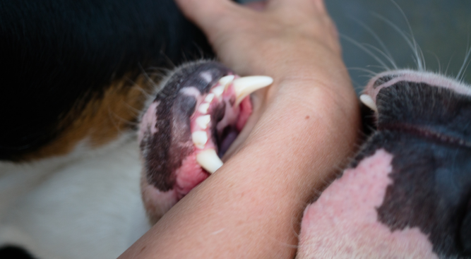 Dog Bite Injury Lawyers in the UK: Seeking Justice for Victims