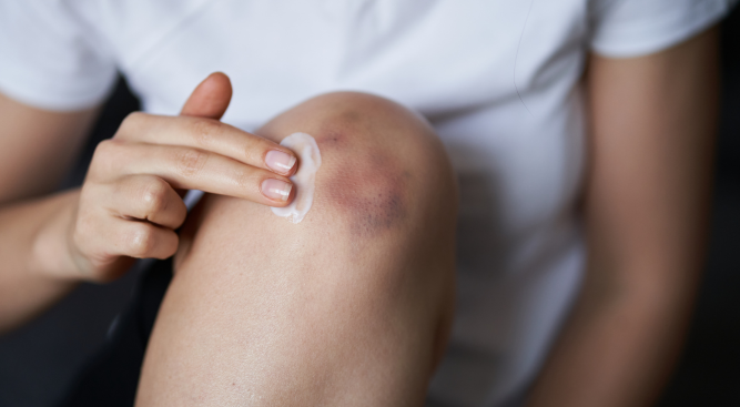 Personal Injury Lawyers: Helping with Injured Knees Claims in the UK