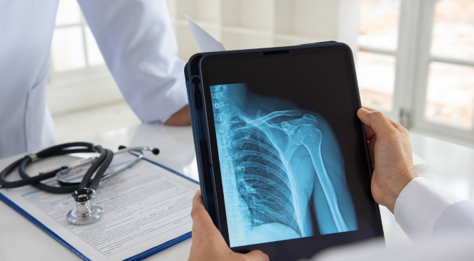 Personal Injury Lawyers Dislocated Joint Claims UK: What You Need to Know