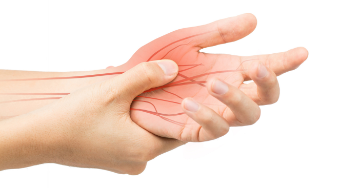 Personal Injury Lawyers for Nerve Impingement Claims in the UK: A Guide