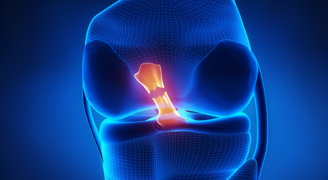 Personal Injury Lawyers for Torn Tendon injury Claims in the UK