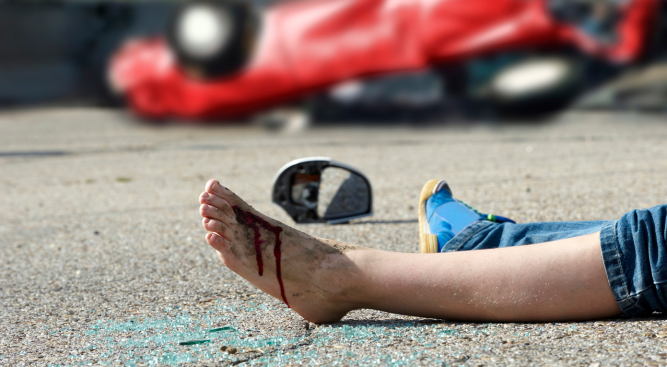 Personal Injury Lawyers: Helping You with Foot Injury Claims After a Car Accident in the UK