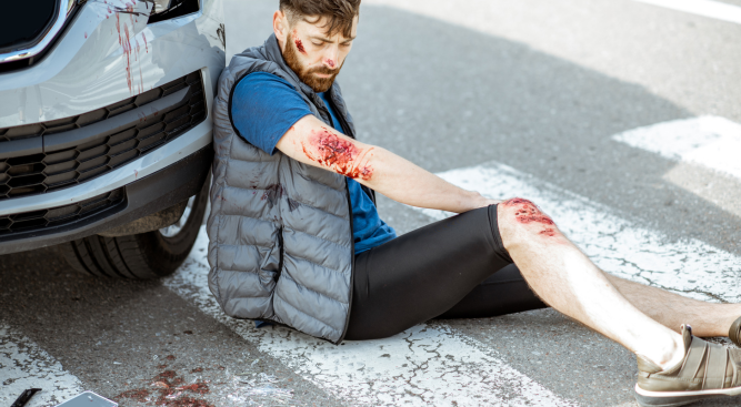 Personal Injury Lawyer for Car Accident Arm Injury Claims in the UK