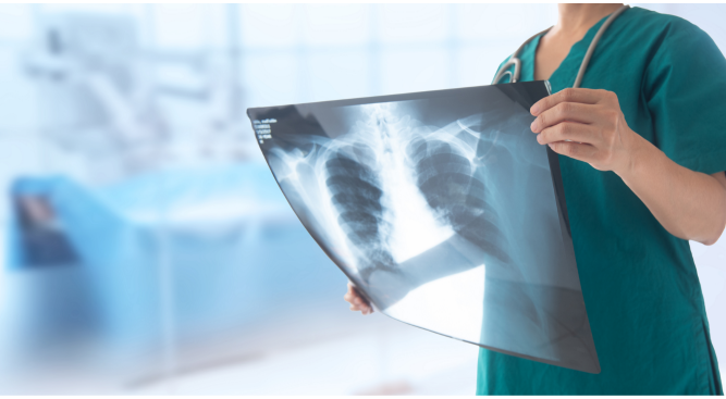 Personal Injury Lawyers Compensation for Silicosis UK: What You Need to Know