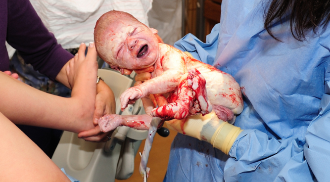 How Much Compensation for Birth Injury can I get in the UK