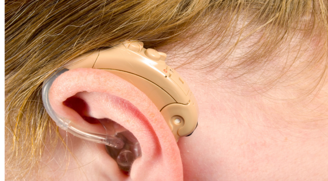 How Much Compensation For Hearing Loss Can I Get in the UK