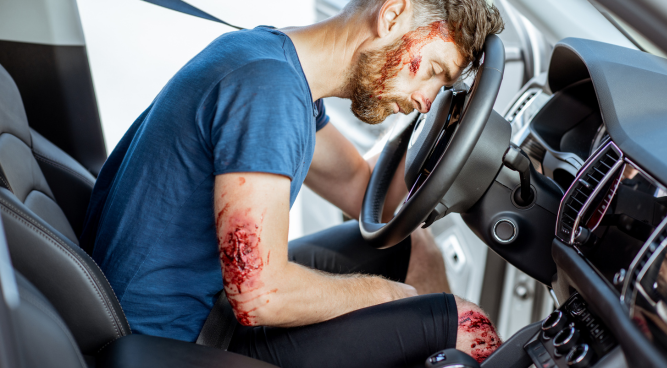 Car Accident Claims for Soft Tissue Injury in the UK